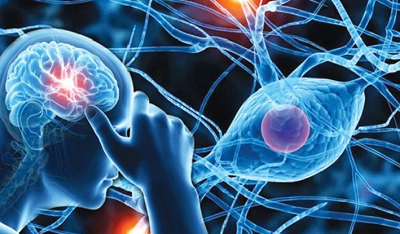 A Review on Diverse Neurological Disorders image